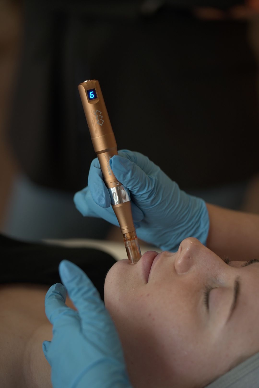 A gloved practitioner holds a rose gold microneedling pen above a woman's lip during a professional skin rejuvenation treatment.