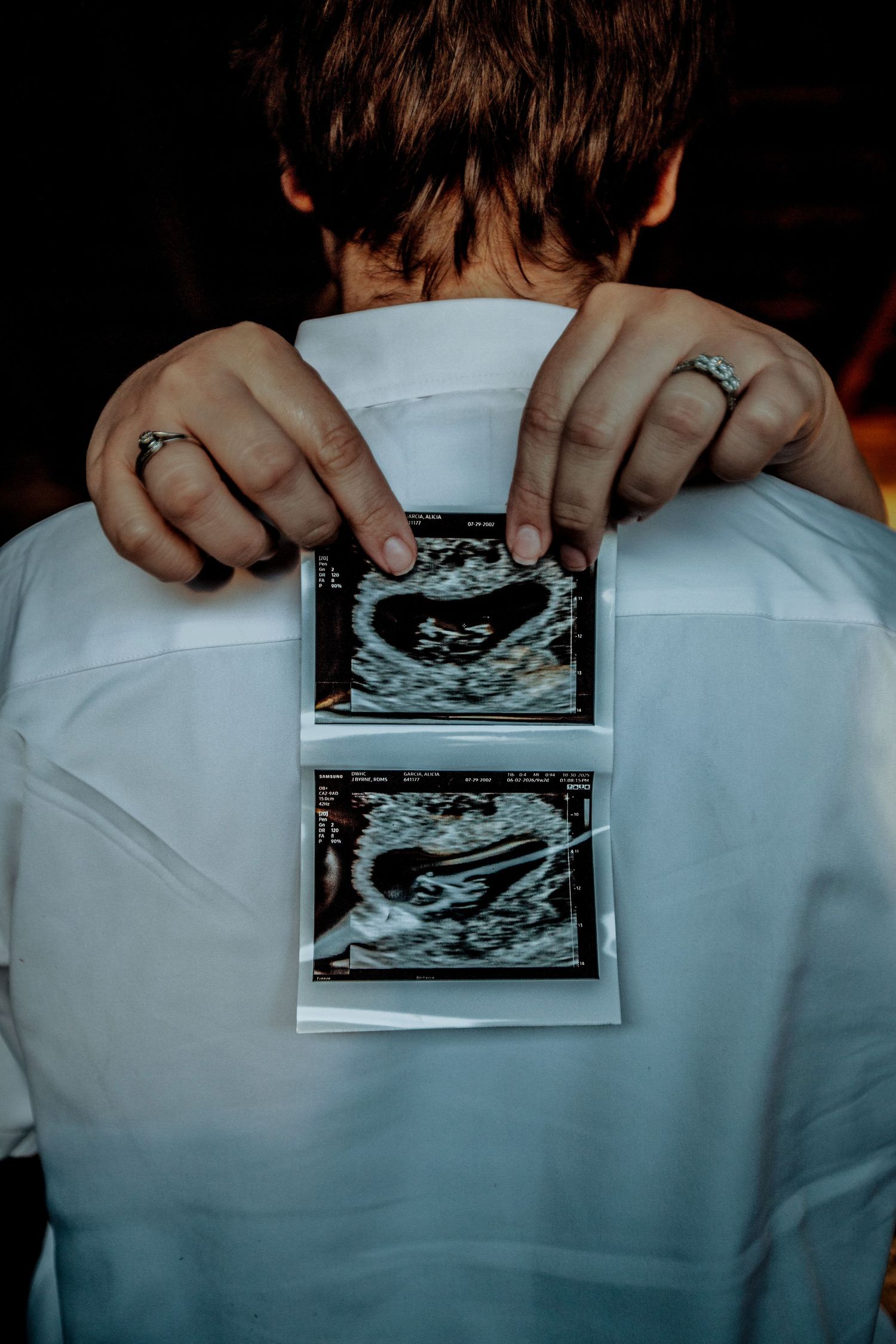 Someone holds two ultrasound sonogram photos against a white shirt, suggesting a pregnancy announcement.