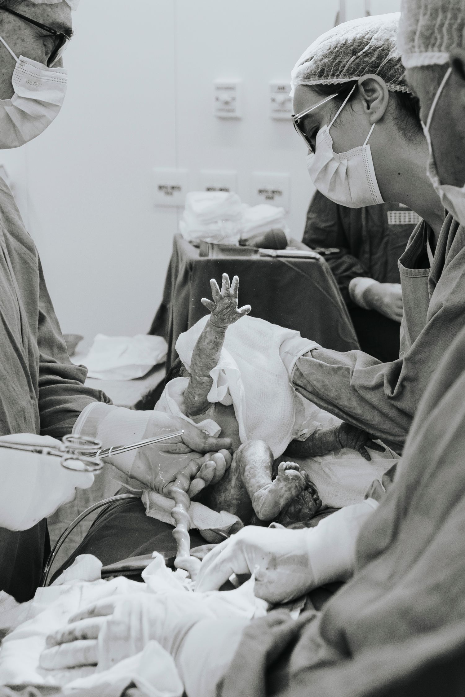 Healthcare team in protective gear attending to newborn baby during medical procedure.