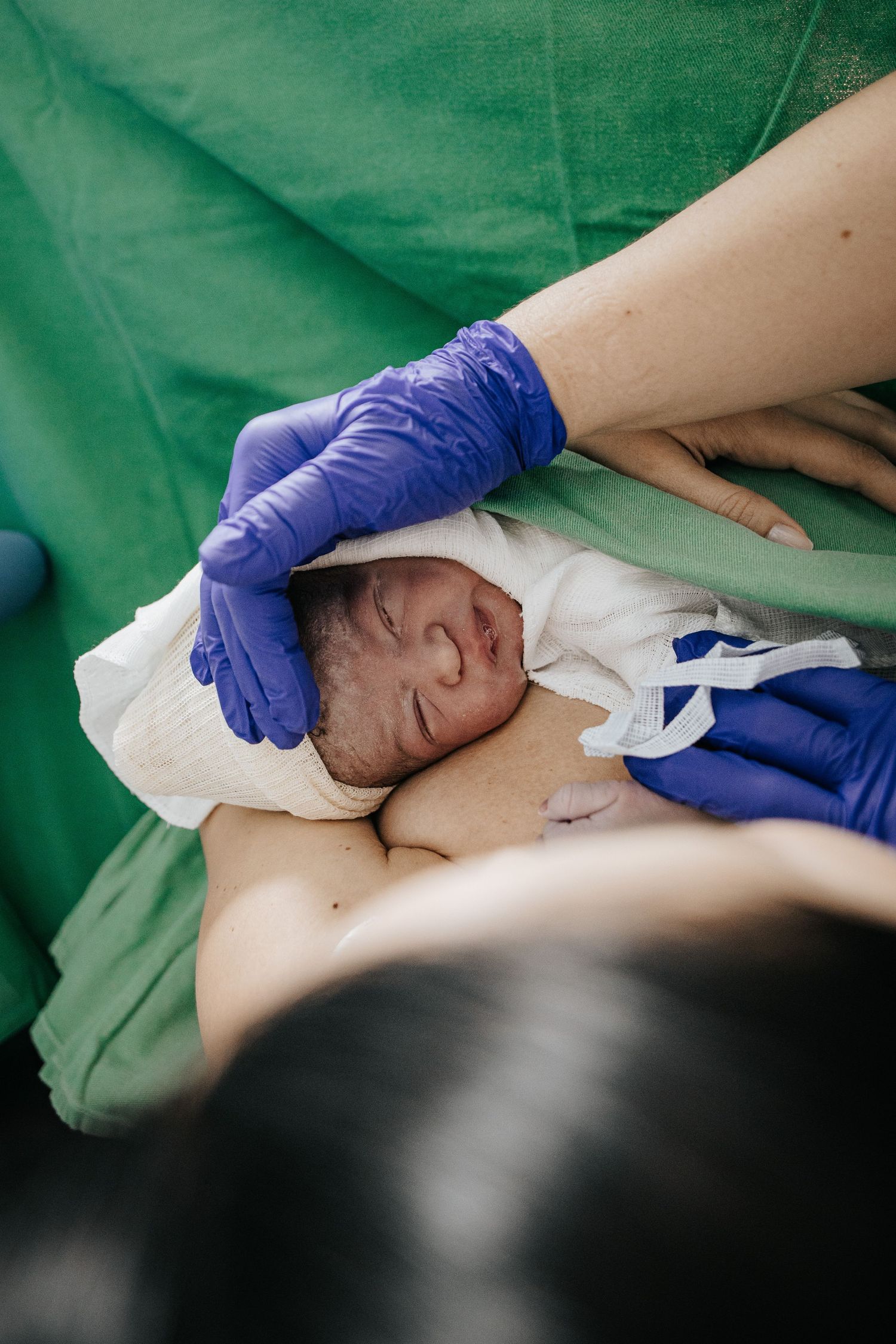 Healthcare provider wearing purple gloves assists during childbirth with green surgical draping visible.