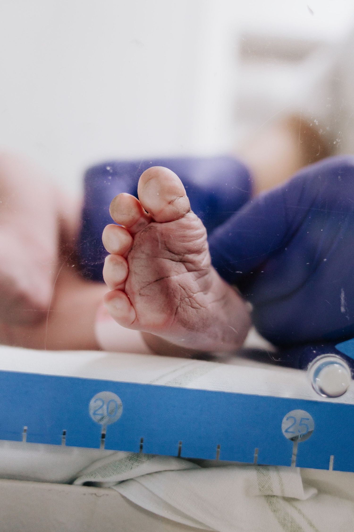 Close-up of tiny baby foot being measured against a blue medical measuring device.