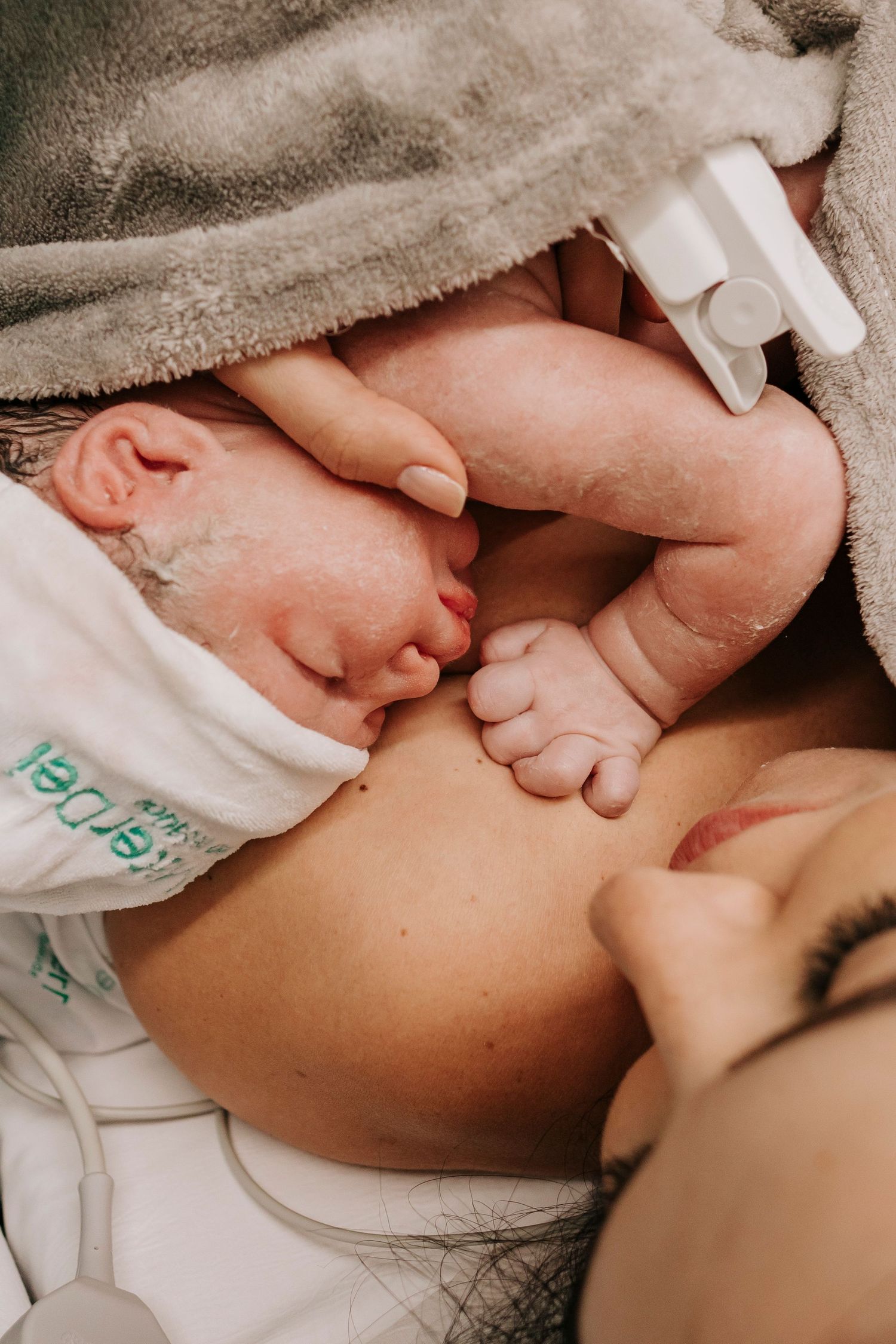 Newborn baby having skin-to-skin contact moments after birth.