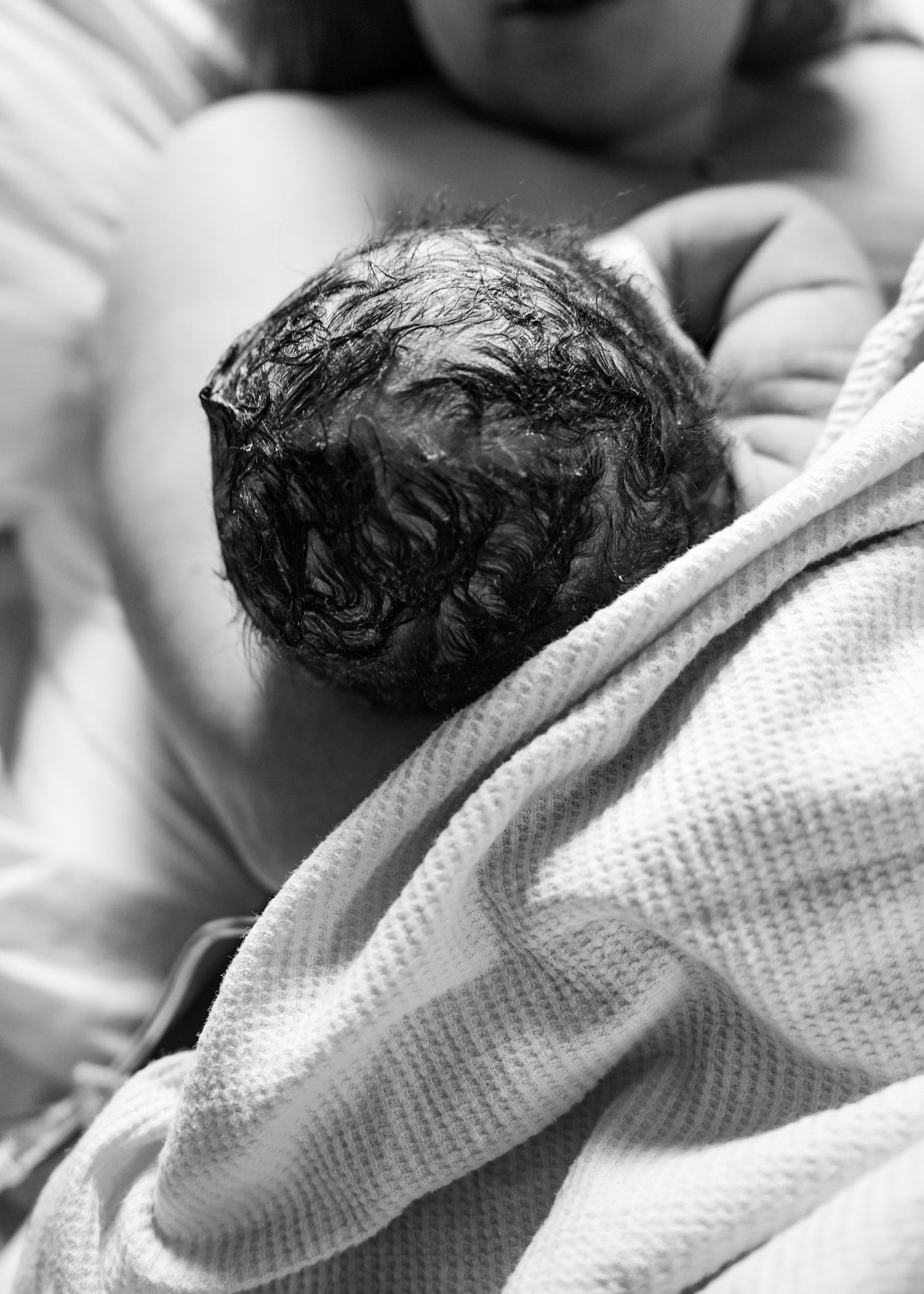 Close-up black and white view of medical treatment with white textured fabric visible.