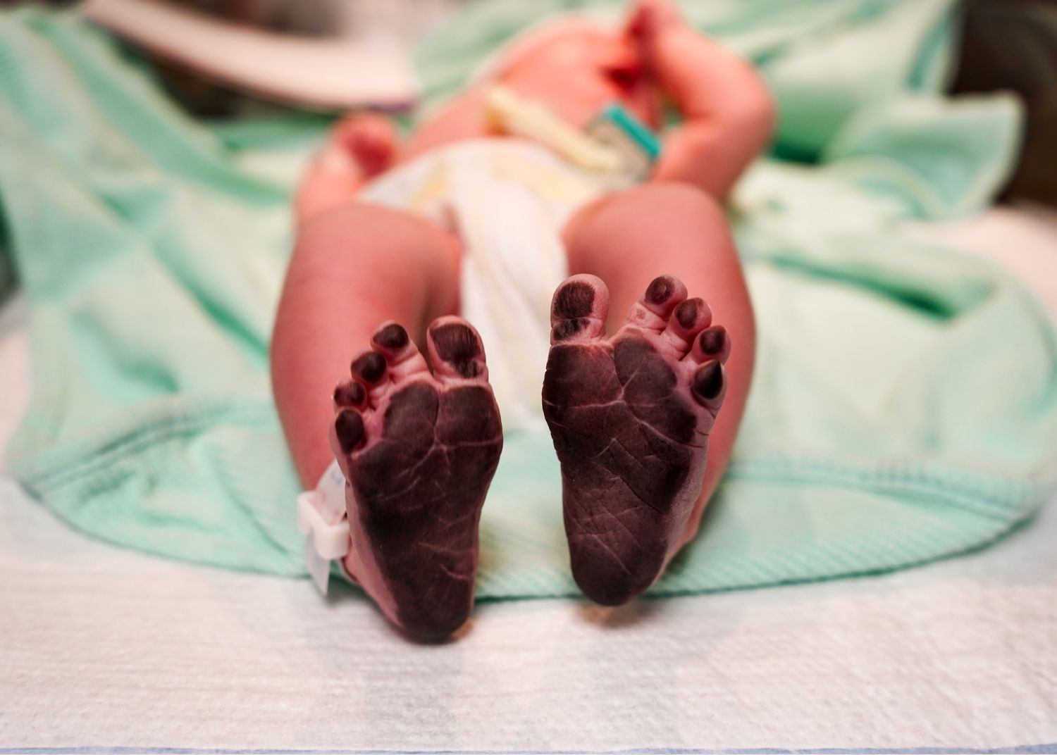 Tiny newborn baby feet shown in close-up detail against mint green medical fabric.