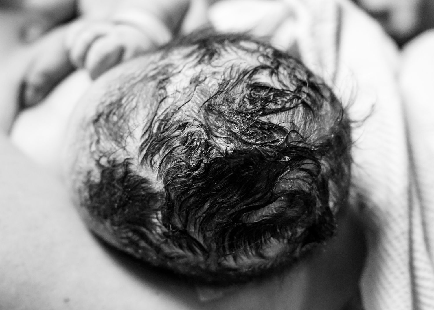 Black and white detail shot of medical procedure with textured material visible.