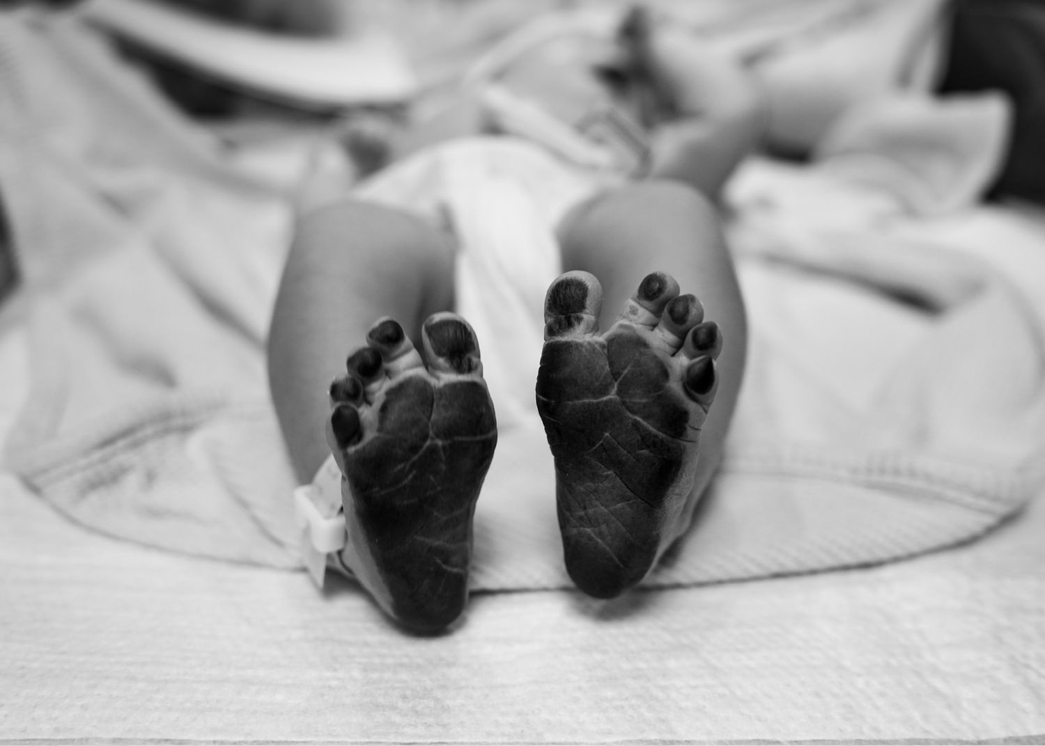 Close-up view of tiny newborn feet on medical examination table.