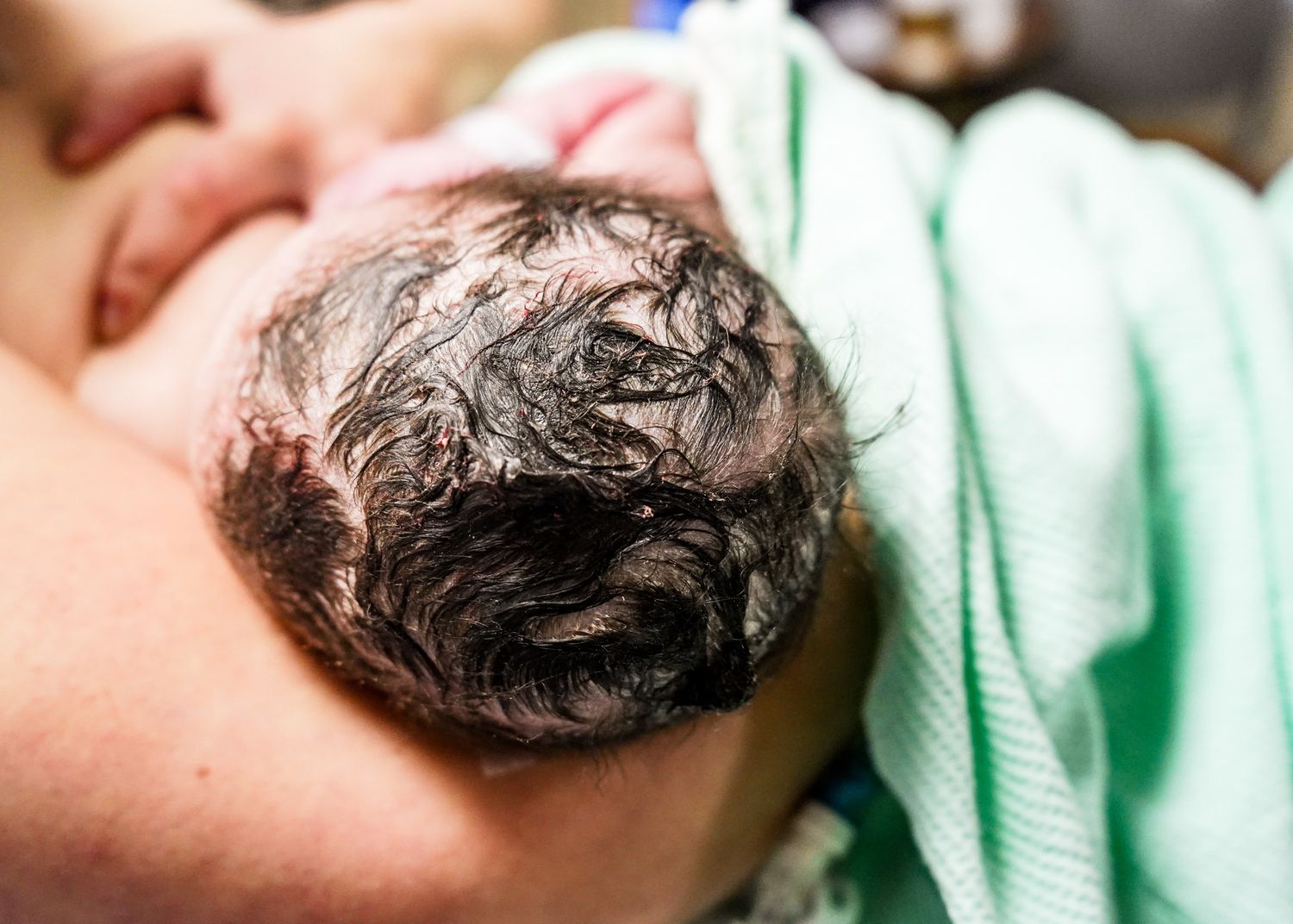 Close-up of dark curly hair against medical linens.
