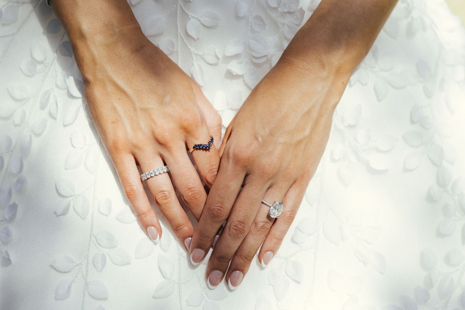 Close-up of hands with wedding rings against white lace fabric.