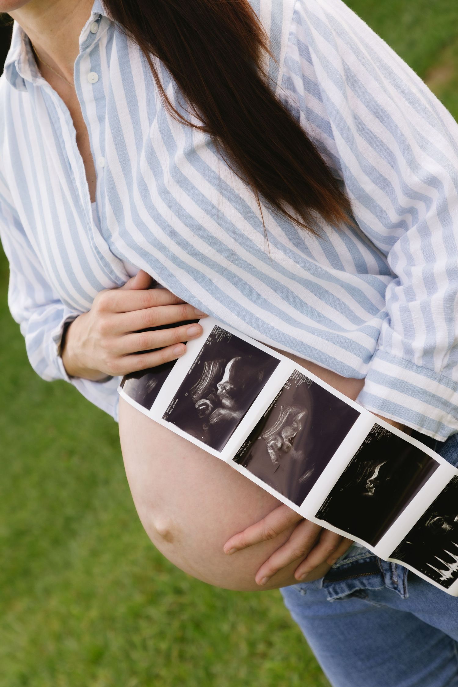 Pregnant woman in striped shirt holding ultrasound photos against her bare baby bump outdoors.