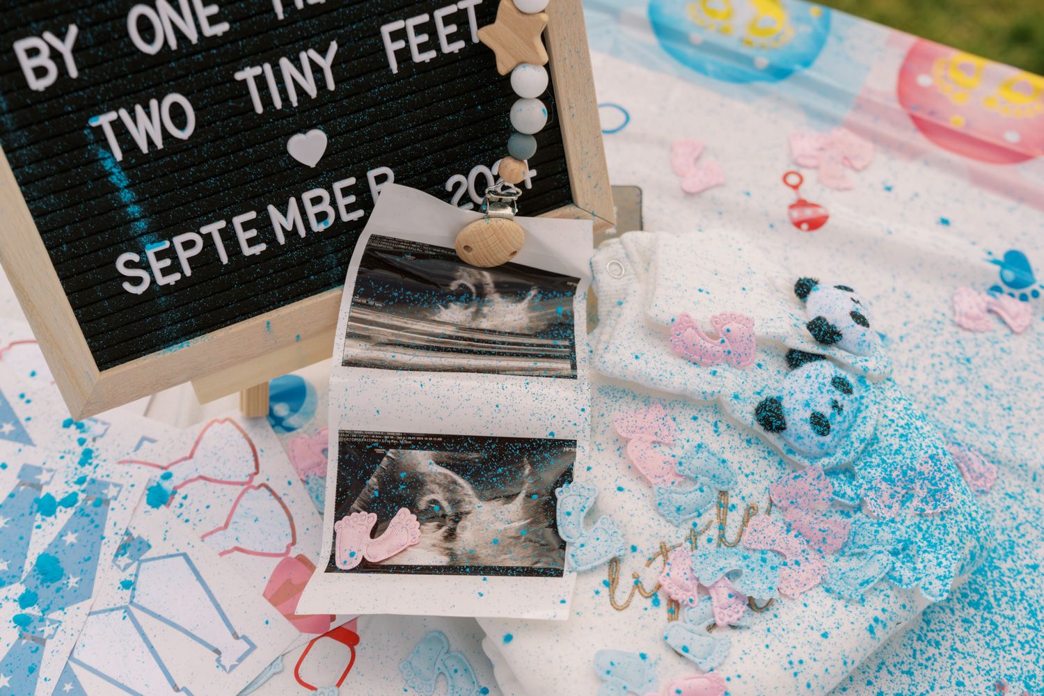 Gender reveal party setup with ultrasound photos, pink and blue confetti, and a letterboard announcing twins due September.