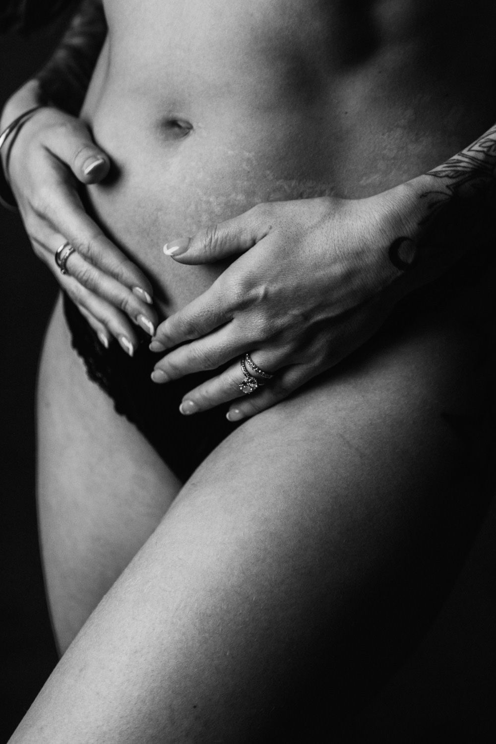 Black and white photo of a woman's torso with hands resting on abdomen, wearing rings and showing a scar.