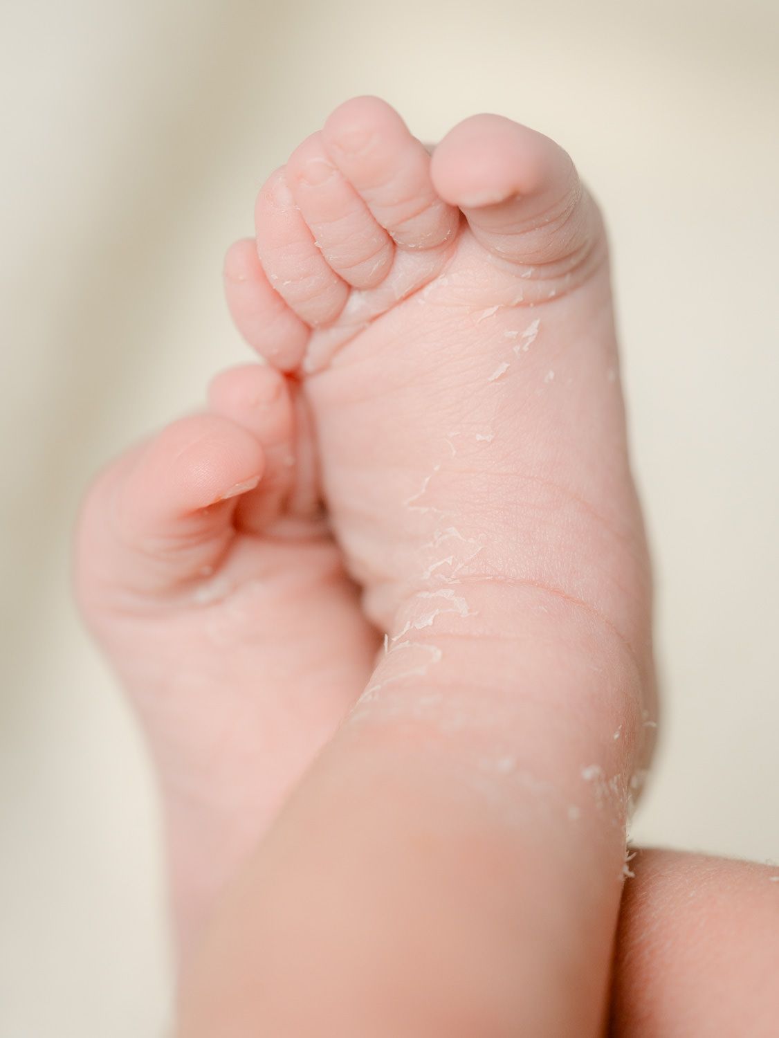 Close-up of a newborn baby's tiny foot with peeling skin, showing delicate toes on a soft beige background.