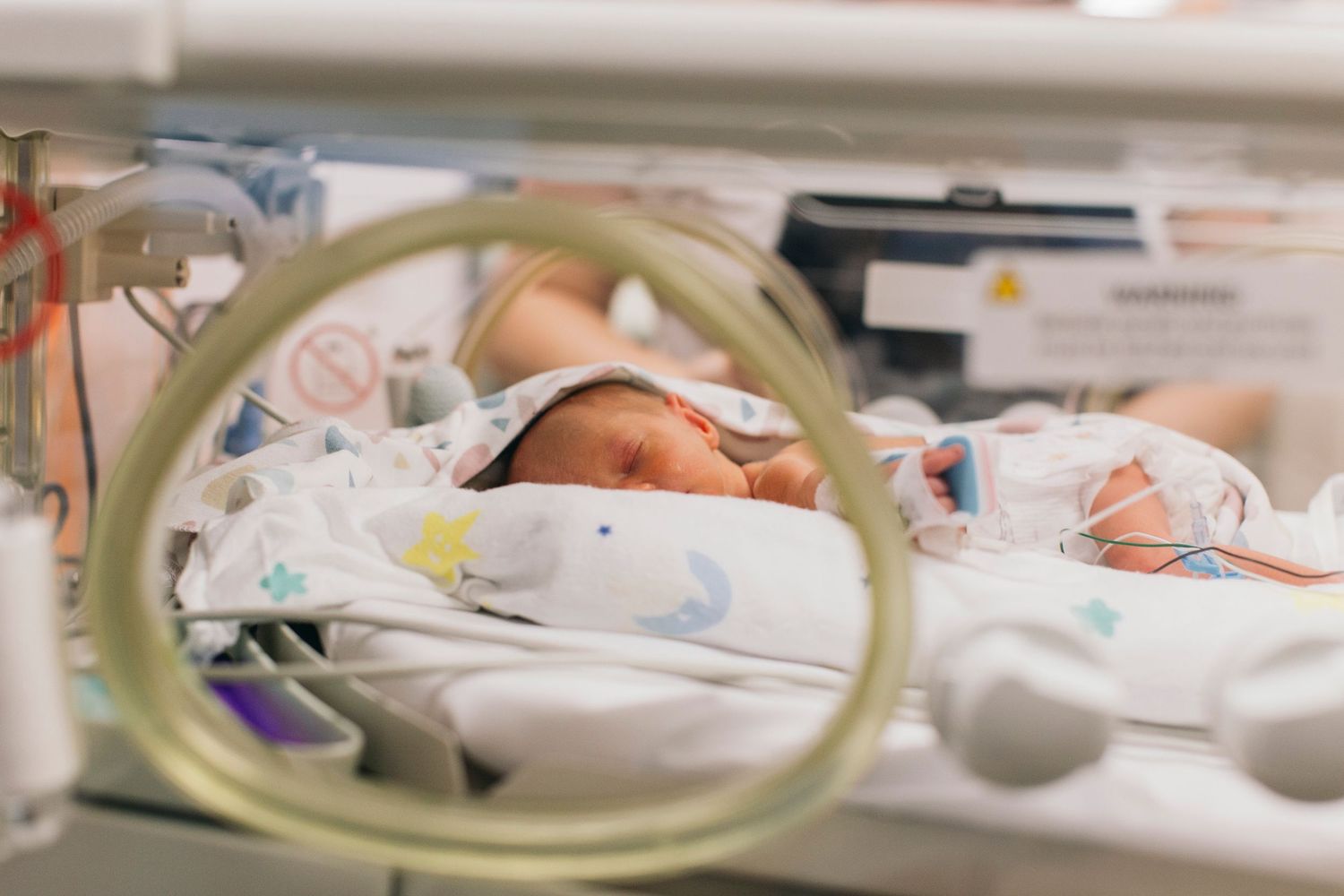 Premature newborn baby sleeping peacefully in a hospital incubator in the NICU ward.