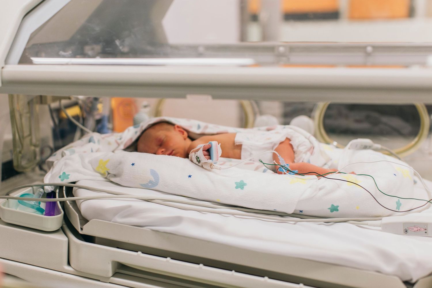 Premature newborn baby resting in a hospital incubator with medical monitoring equipment in the NICU.
