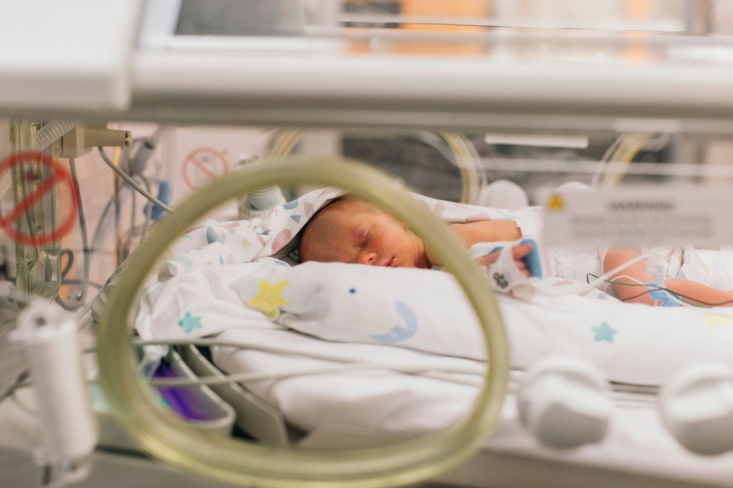 Premature newborn baby sleeping peacefully in a hospital incubator with medical monitoring equipment in the NICU.