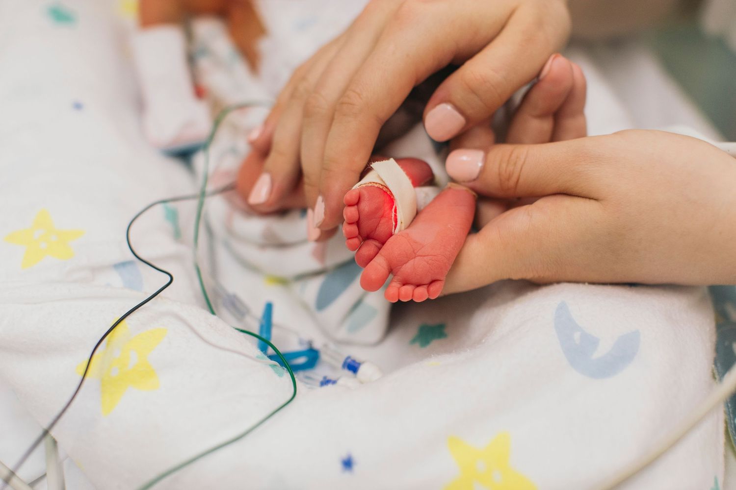 Adult hands gently holding tiny premature newborn baby feet in a hospital NICU setting with star-patterned blanket.