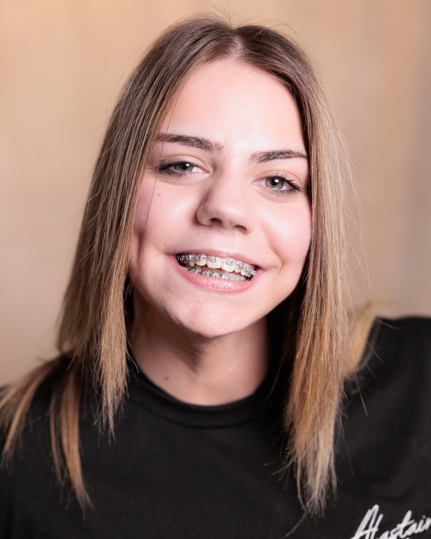A sequence of six close-up shots showing someone smiling and wearing braces against a neutral background.