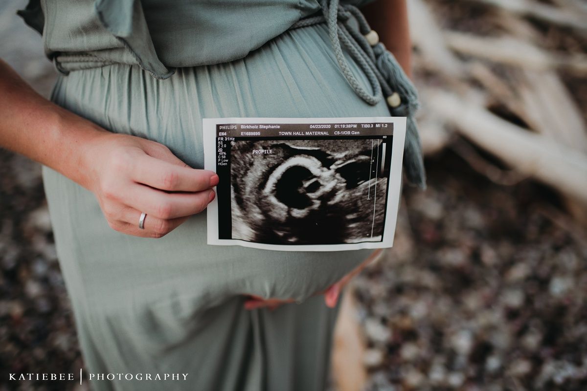 Hands hold an ultrasound photo against a sage green dress backdrop.
