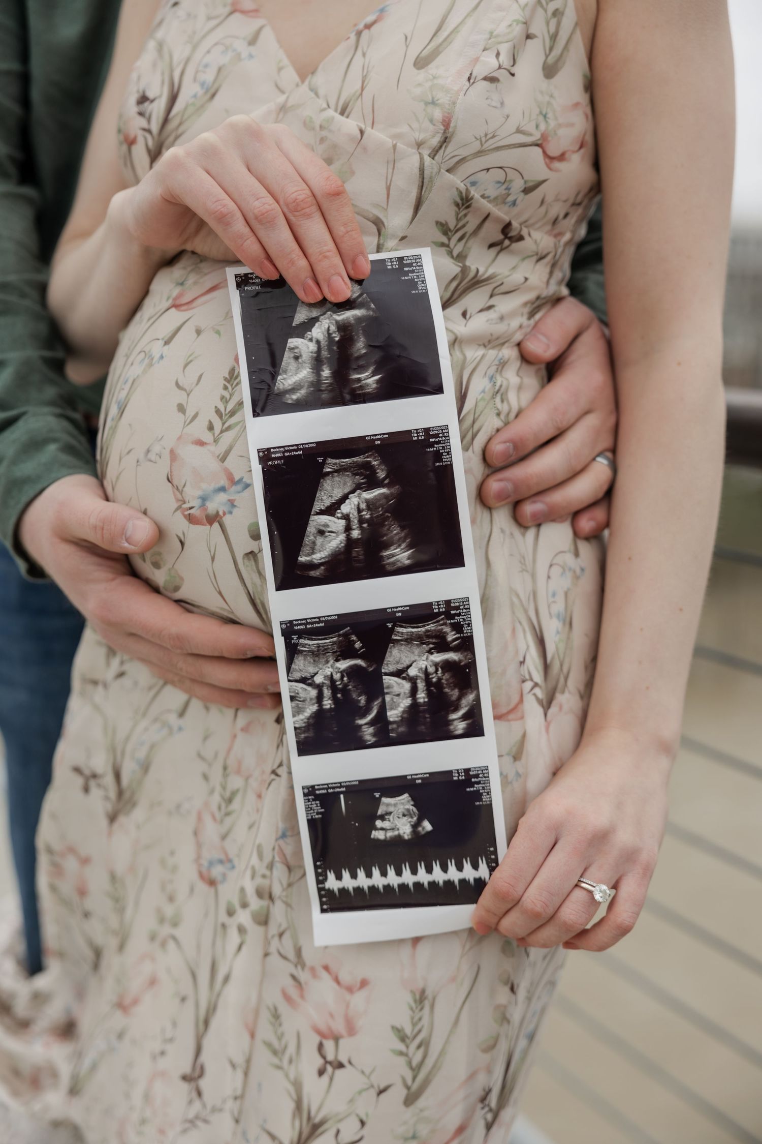 Close-up of hands holding ultrasound photos against a floral dress during pregnancy announcement.
