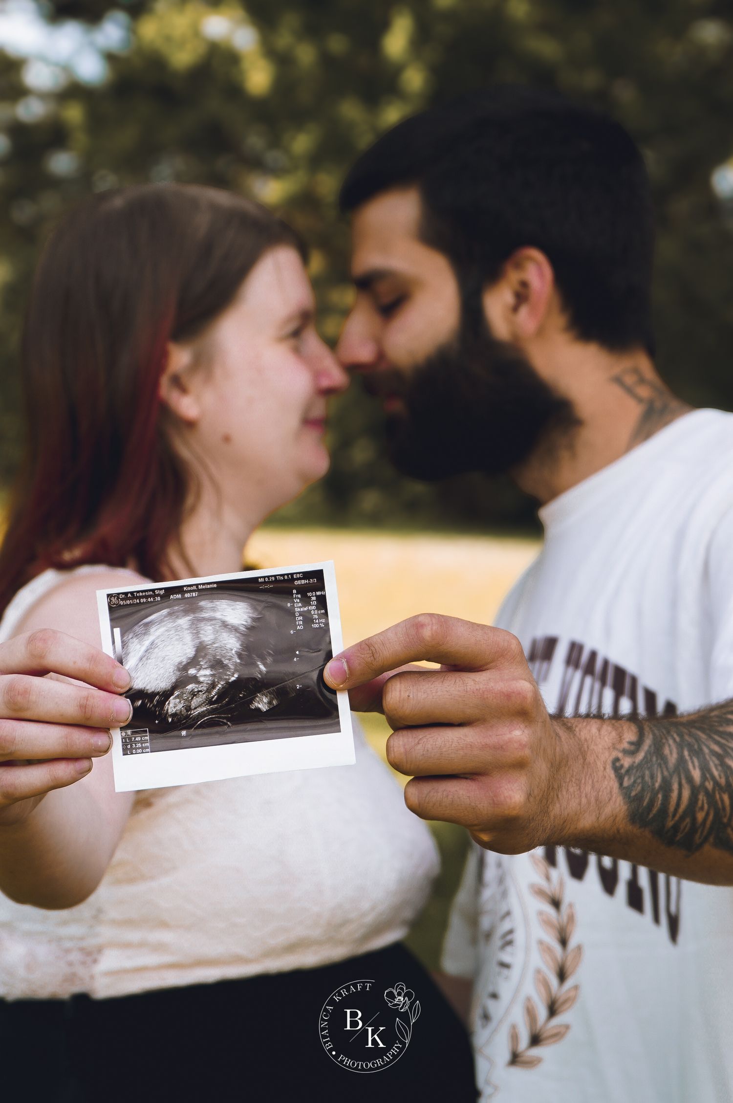 Schwangere bei Babybauchshooting im Grünen in Stuttgart