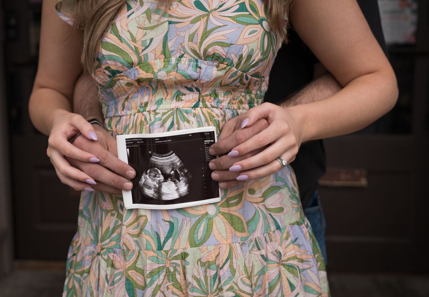 Pregnancy announcement photo.
