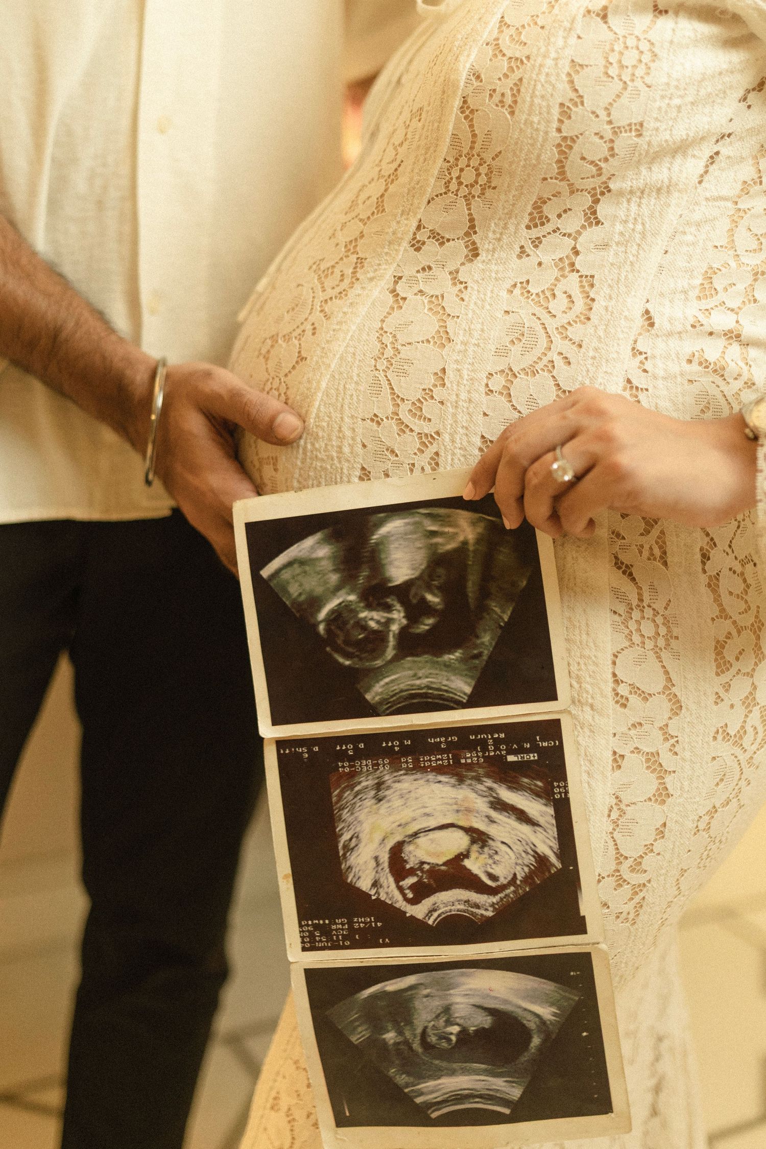 Hands hold ultrasound images against a delicate lace dress, capturing a special pregnancy announcement moment.