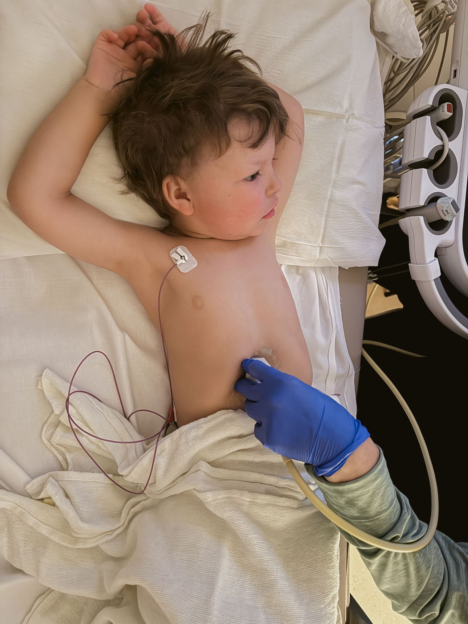 Young child lying in hospital bed with medical monitoring equipment and a gloved healthcare worker providing care.