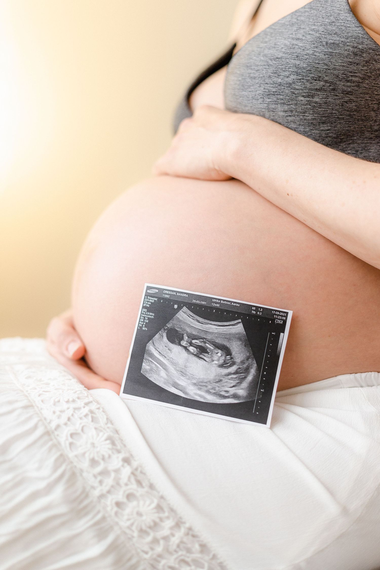 Black and white ultrasound image displayed on pregnant belly showing developing baby in the womb.