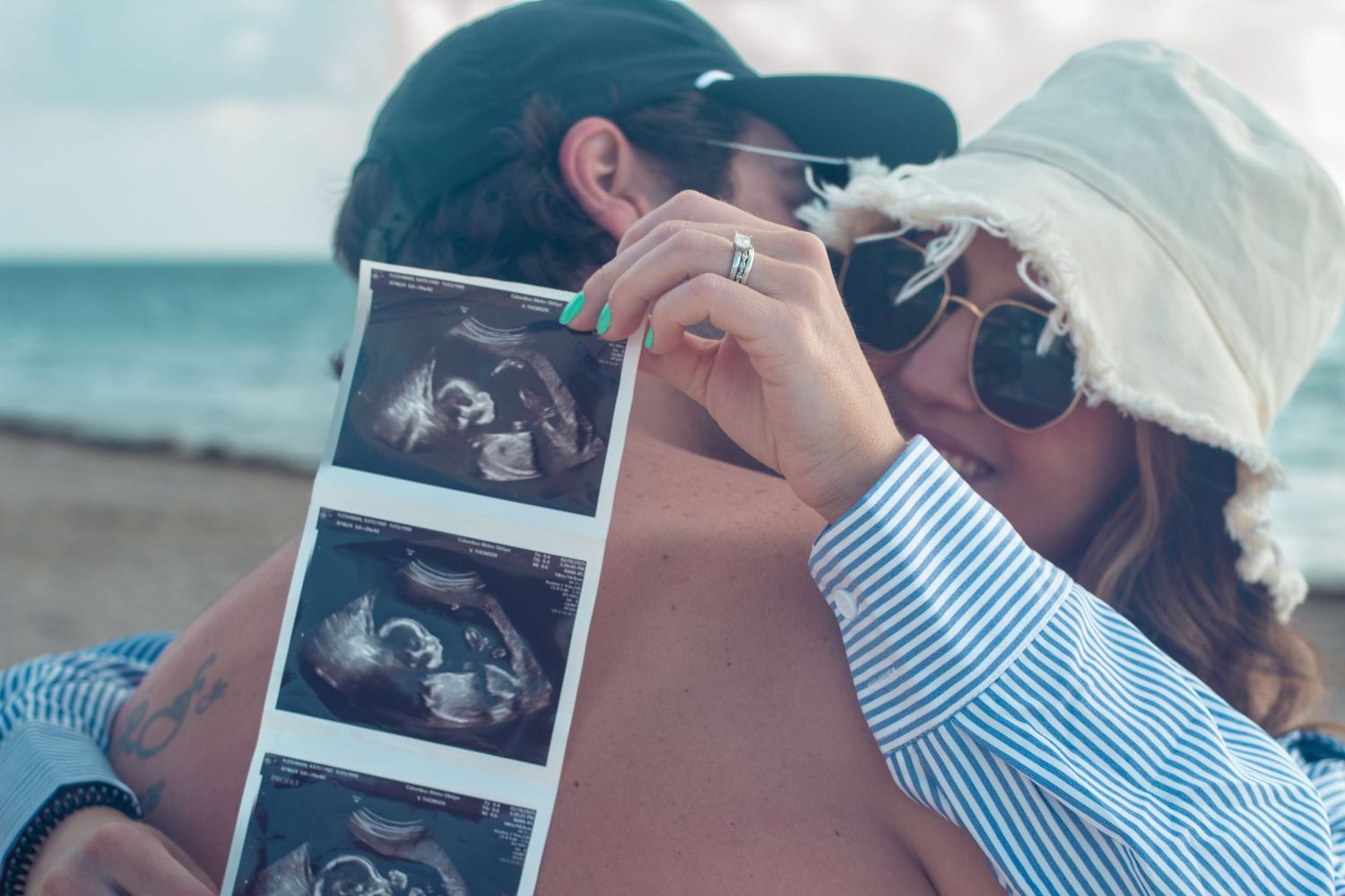 A couple in matching blue striped shirts share tender moments while posing with ultrasound photos on a beach.