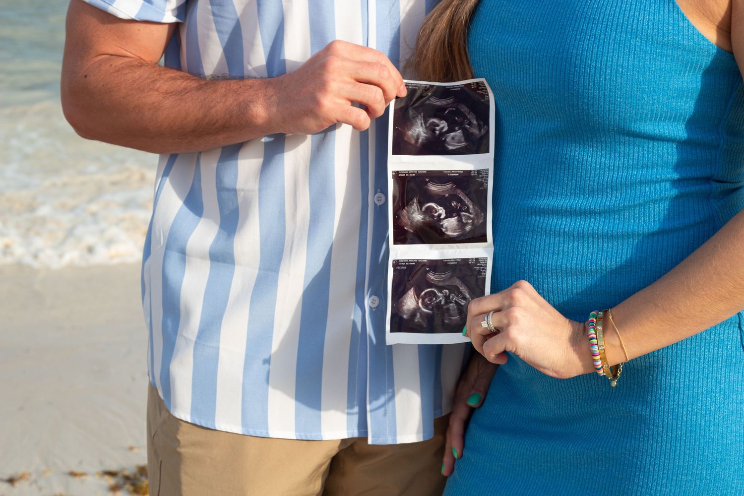 Couple on beach holding three ultrasound photos showing their pregnancy announcement.