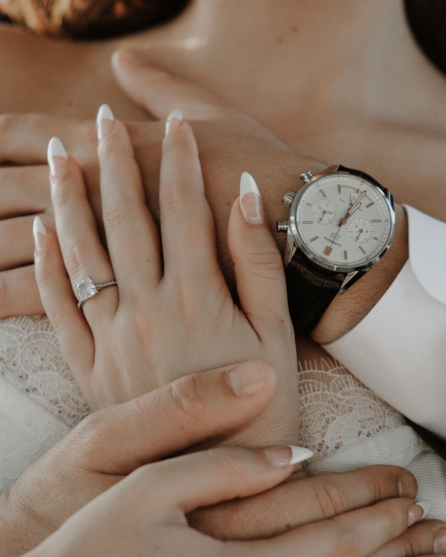 Close-up of hands with engagement ring and elegant watch resting on white lace fabric.