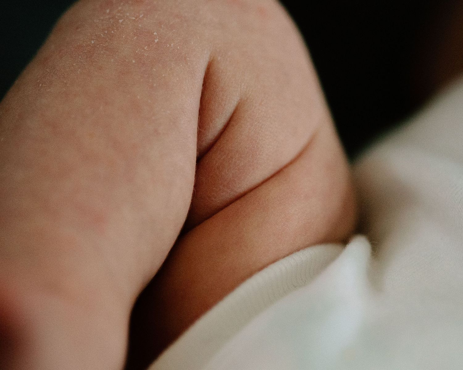 Close-up macro shot of a baby's chubby arm resting on white fabric.