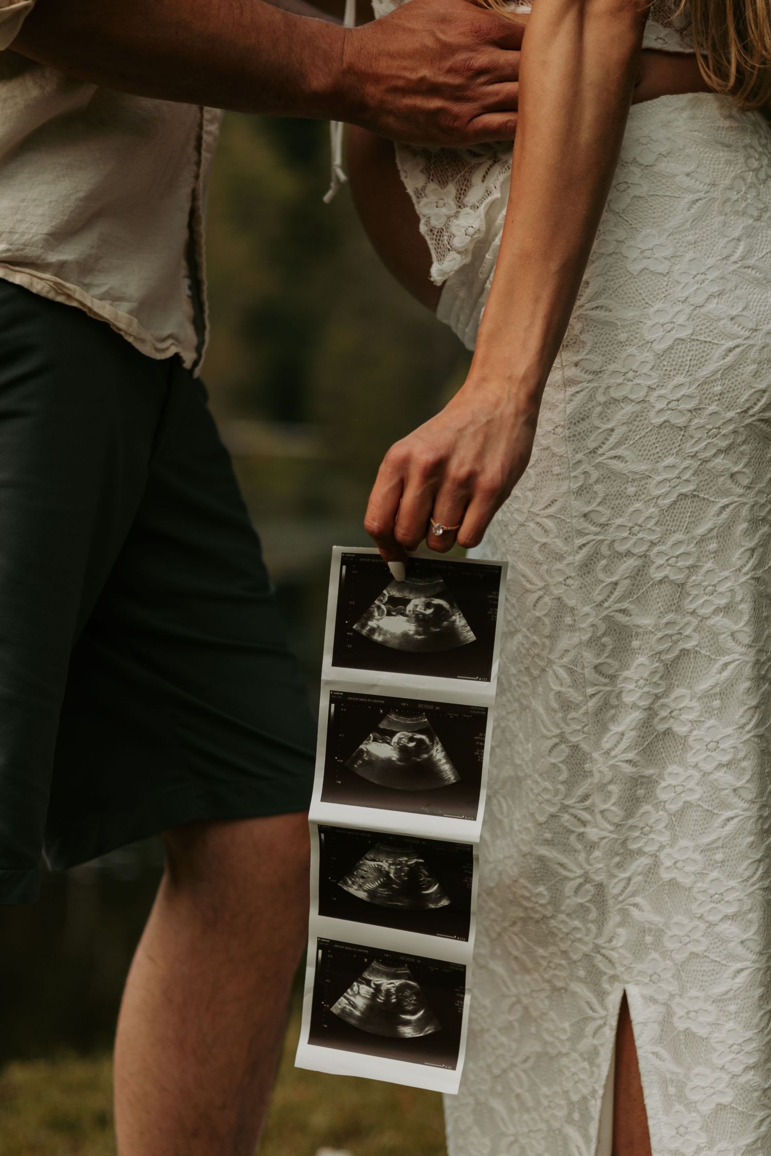 Close-up of couple holding ultrasound scan photos against white dress in outdoor setting.