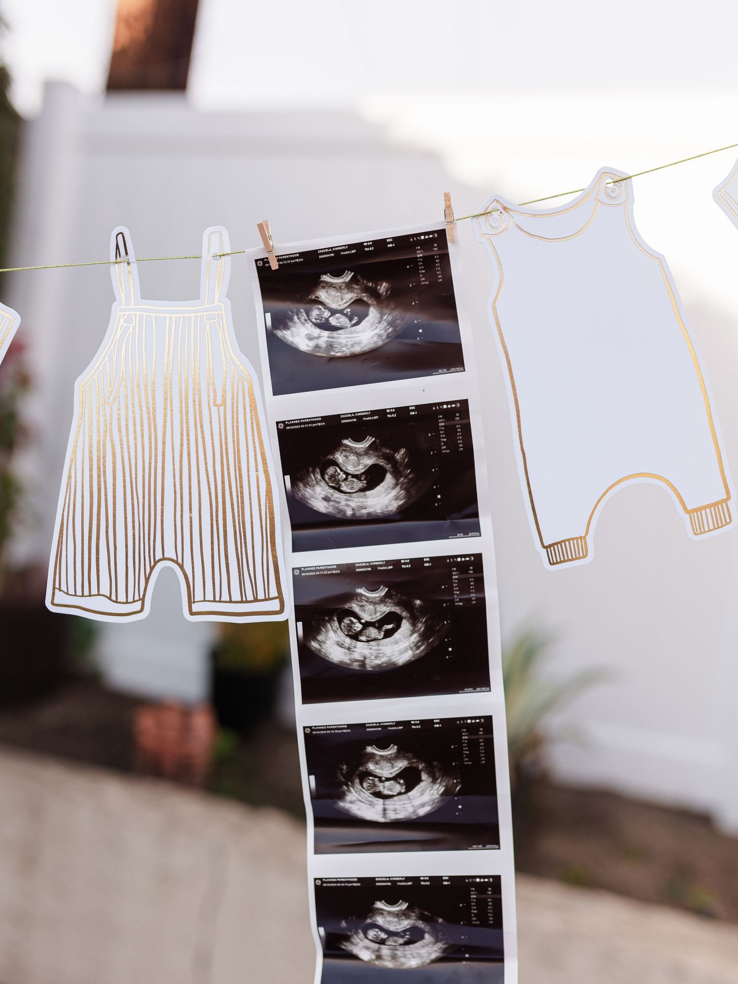 Baby clothes and ultrasound photos hang on a white string against a light background.
