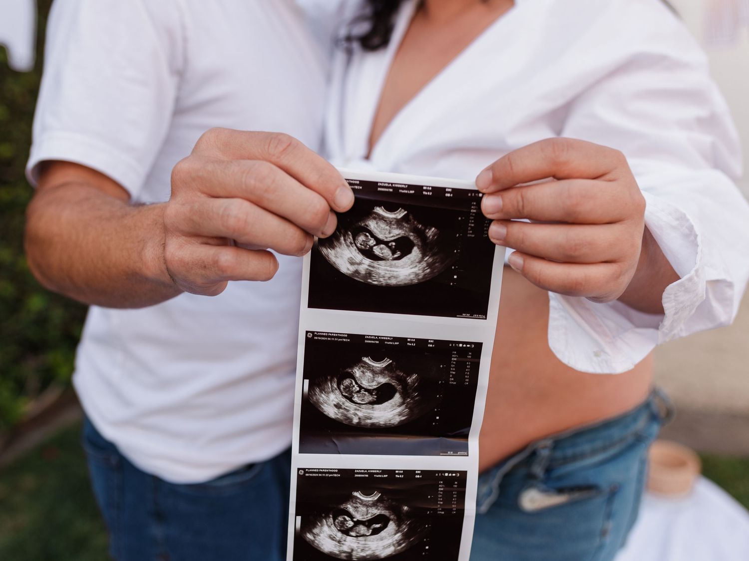 Hands holding ultrasound photos during pregnancy announcement photoshoot.