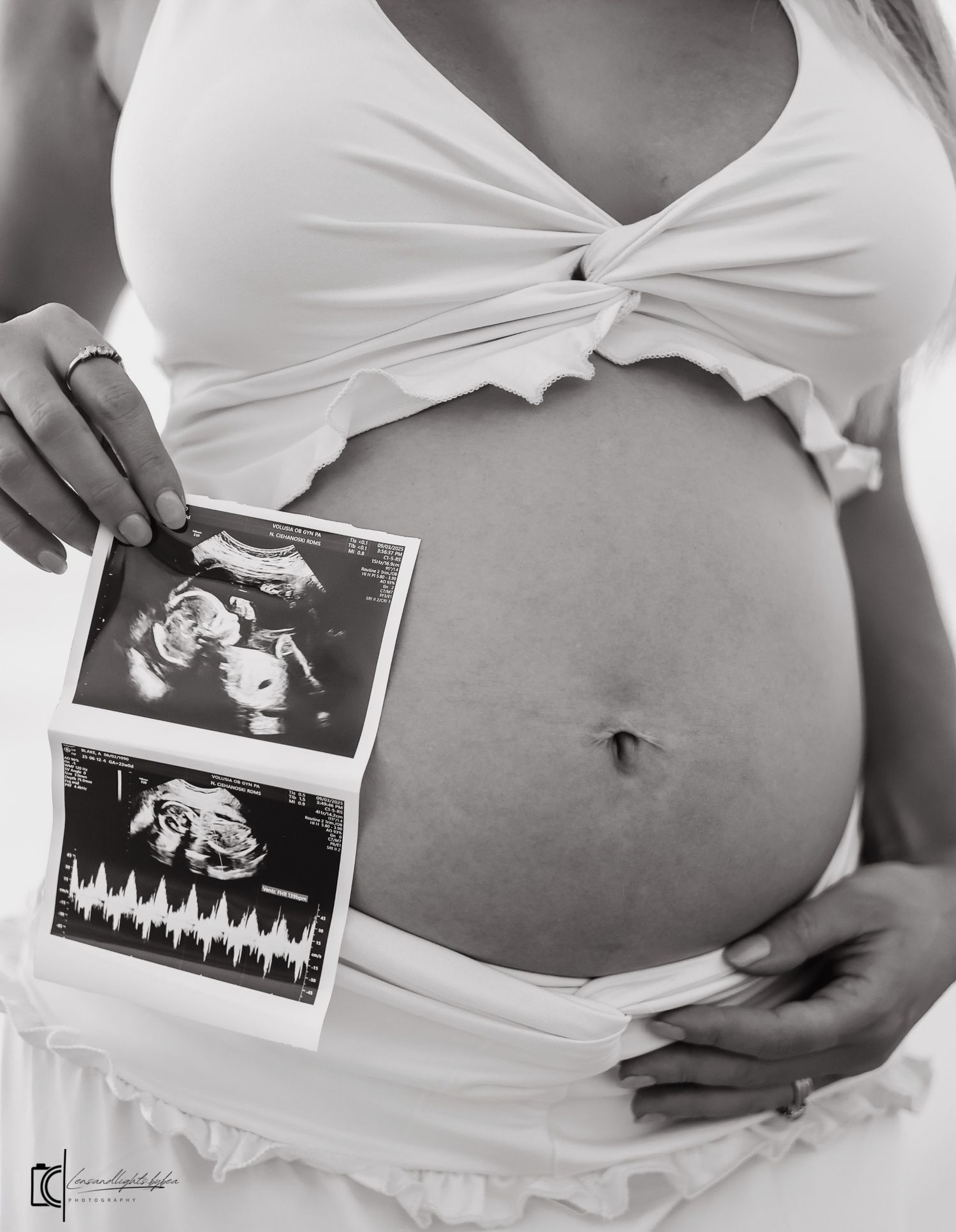 A series of black and white ultrasound photos displayed on a pregnant woman's bare belly in white clothing.