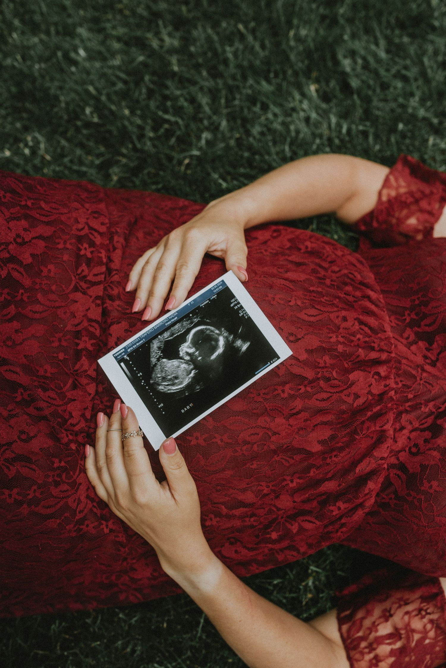 an ultrasound on a pregnant belly with the hands framing it