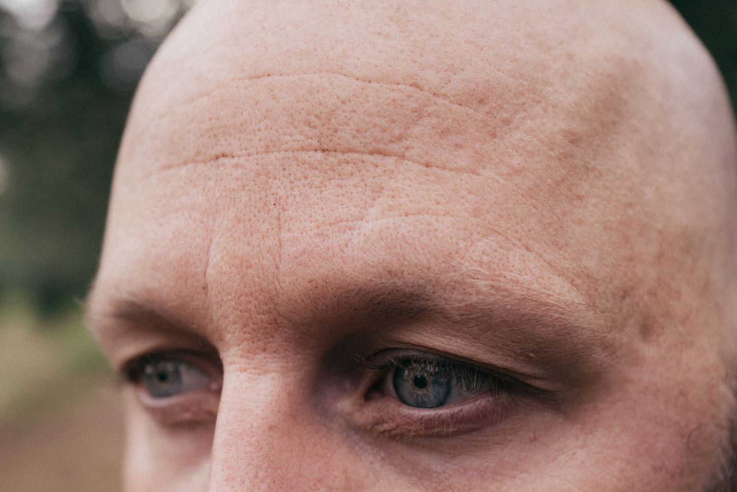 Close-up shot of bright blue eyes and eyebrows against pale skin.