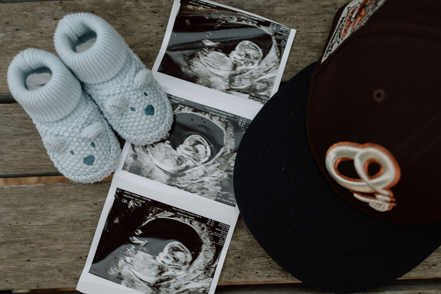 Baby booties, ultrasound photos, and a cap arranged on rustic wooden surface for pregnancy announcement.