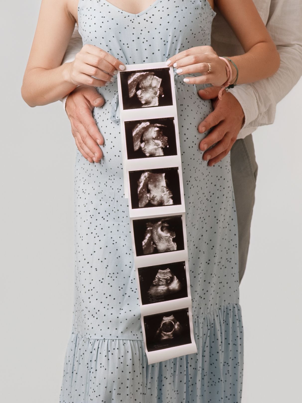 Pregnant couple holding ultrasound photo strip showing baby scan images, woman in blue floral dress, maternity announcement photo.