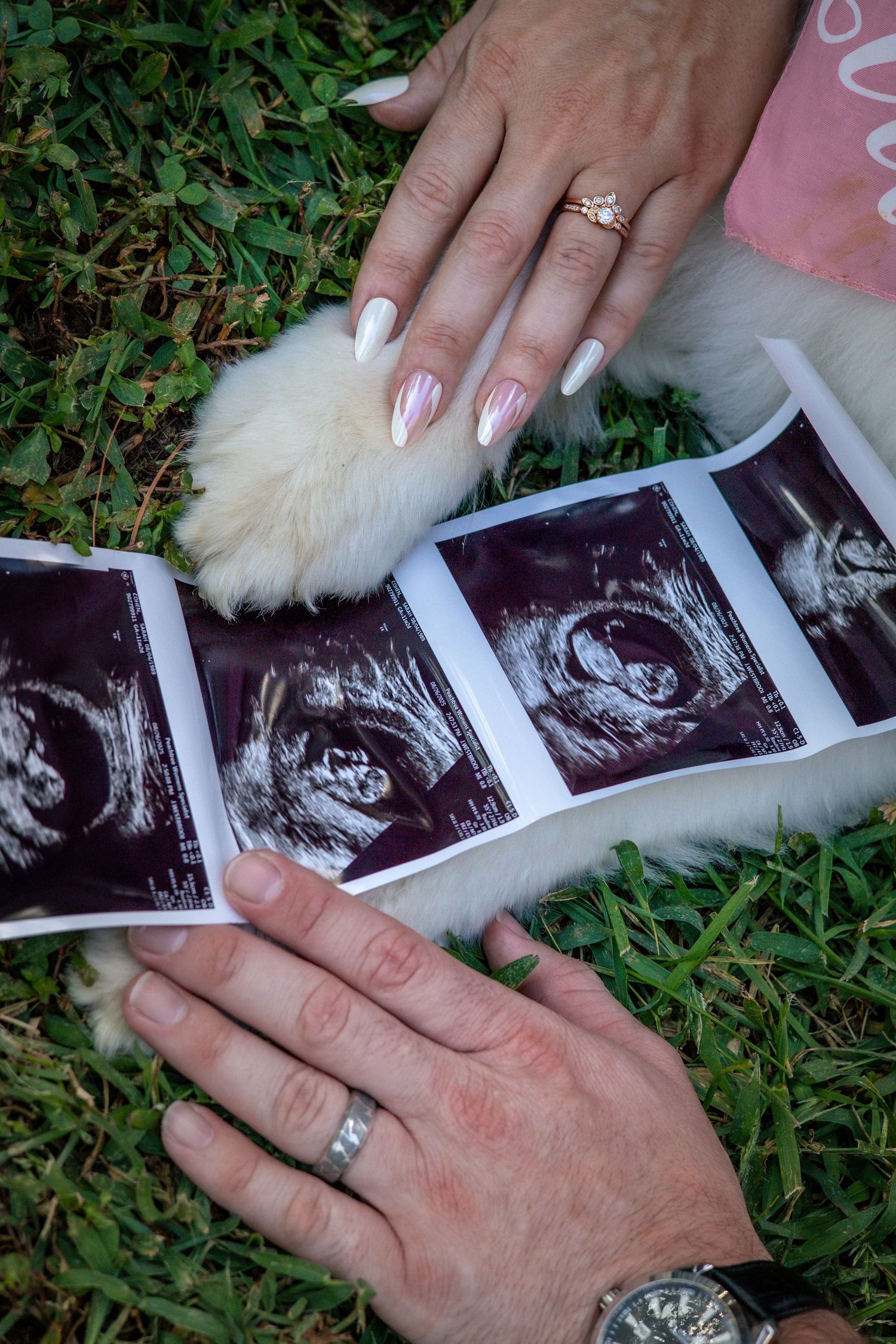Hands with wedding rings holding ultrasound photos on grass next to white fur.