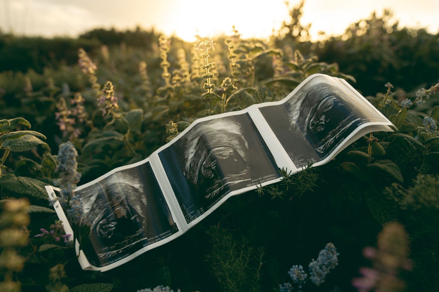 Ultrasound photos resting in a lush green field at golden hour, capturing a precious pregnancy announcement moment.