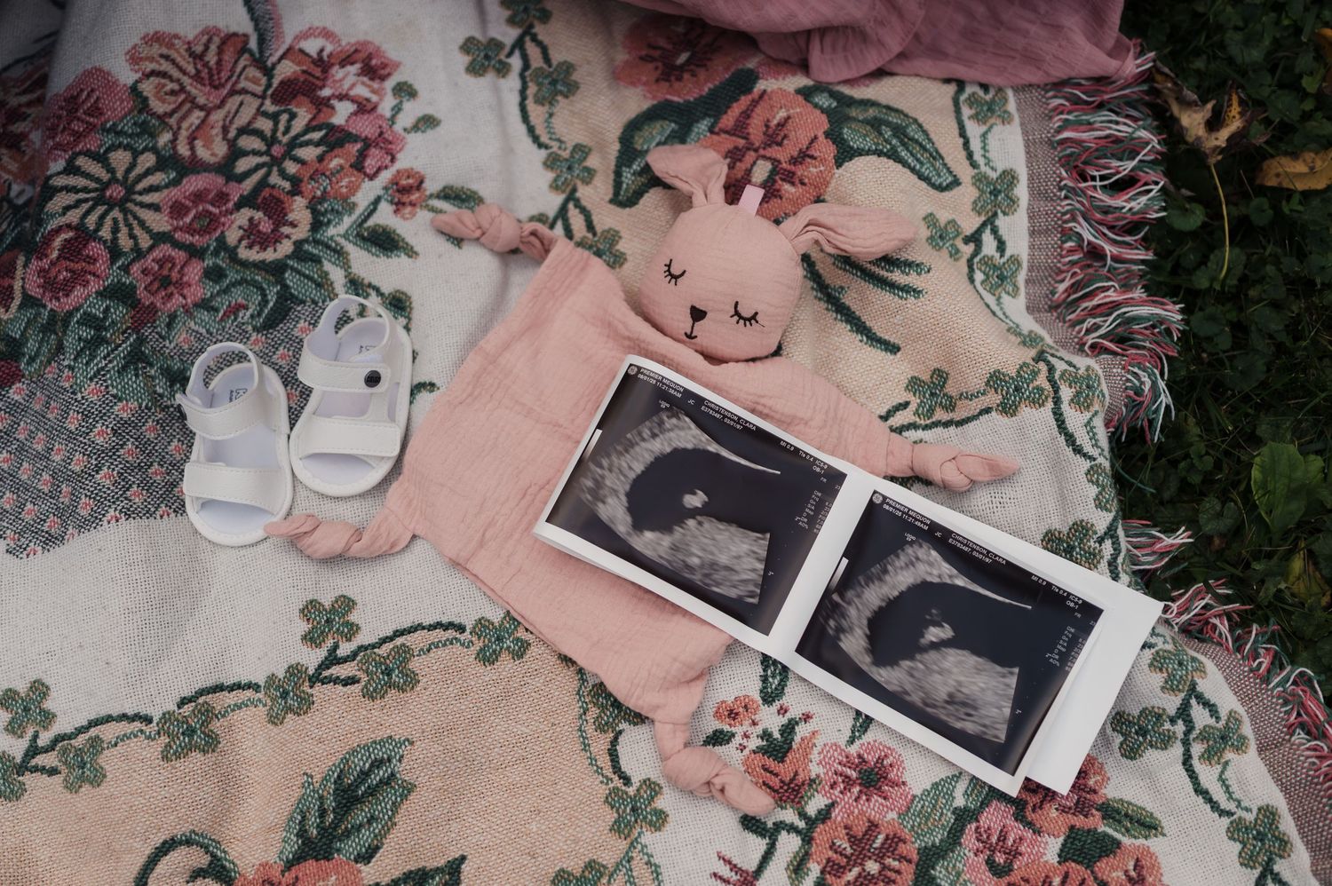 Baby ultrasound photos, white sandals, and a pink bunny toy on a floral blanket outdoors.