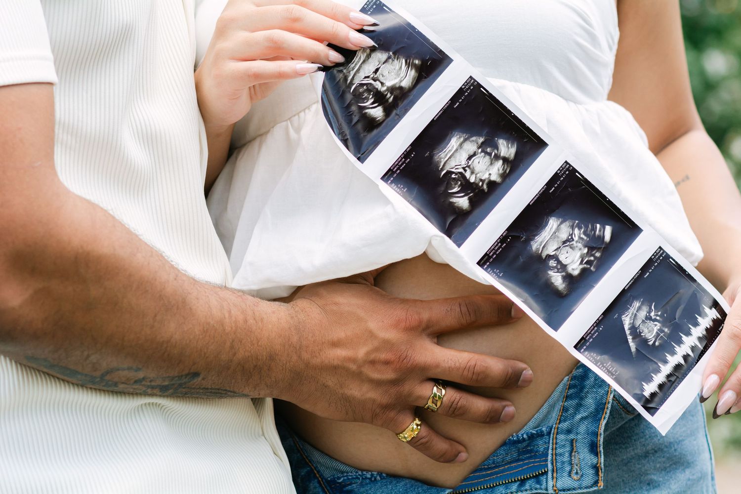 Close-up of hands holding ultrasound photos against white clothing.