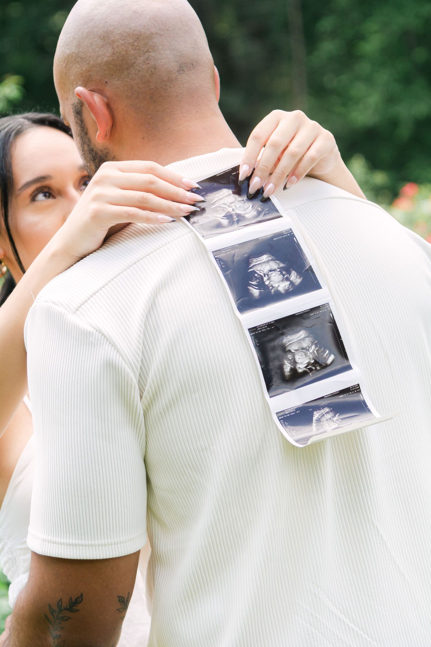 A couple holding ultrasound photos while embracing in a romantic garden setting with white attire.