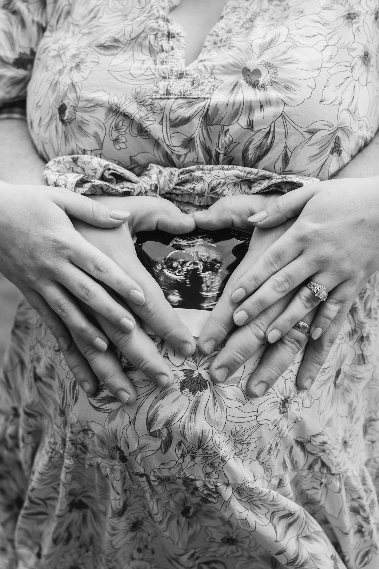 Black and white photo of hands forming heart shape over ultrasound photo on floral dress.
