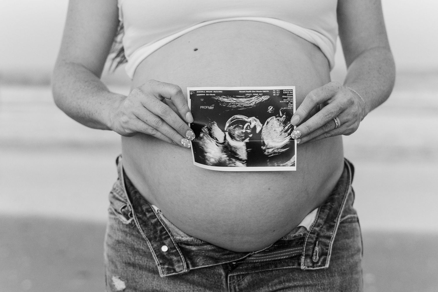 A black and white photo showing an ultrasound image held against a pregnant belly.