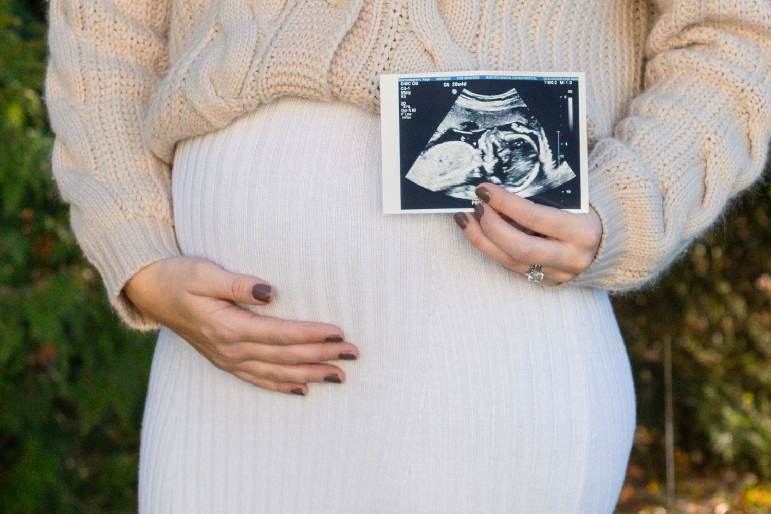 Pregnant woman in beige sweater holding ultrasound photo while cradling baby bump outdoors.