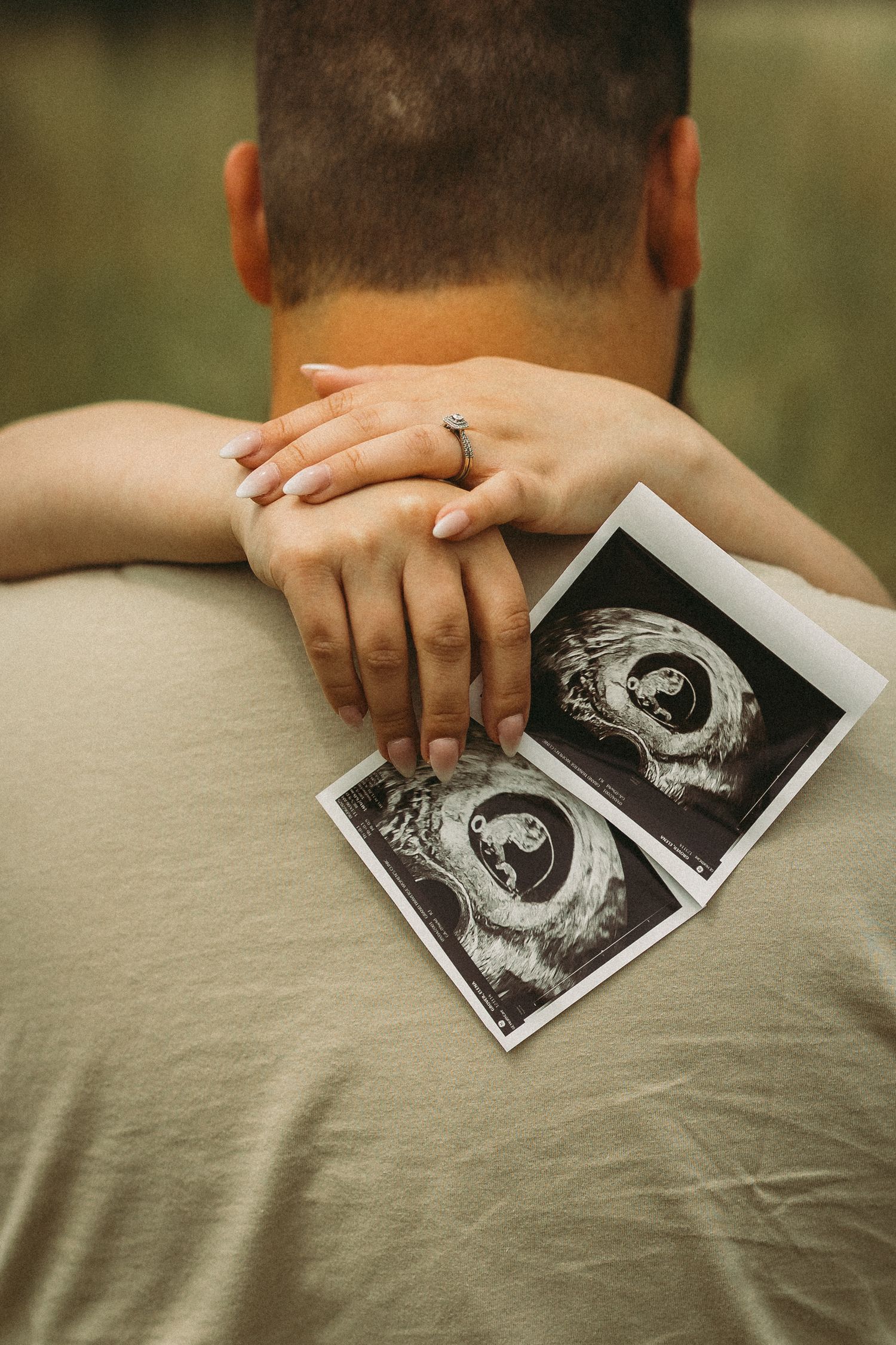 Ultrasound photos displayed on shoulder showing early pregnancy scan images.