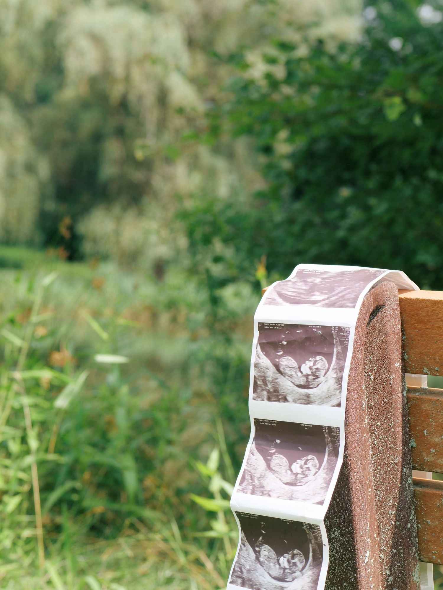 Ultrasound photos leaning against a wooden bench outdoors with lush green nature background.